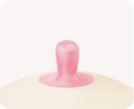 授乳不要 縮小 術前