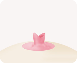 授乳不要 縮小 術後