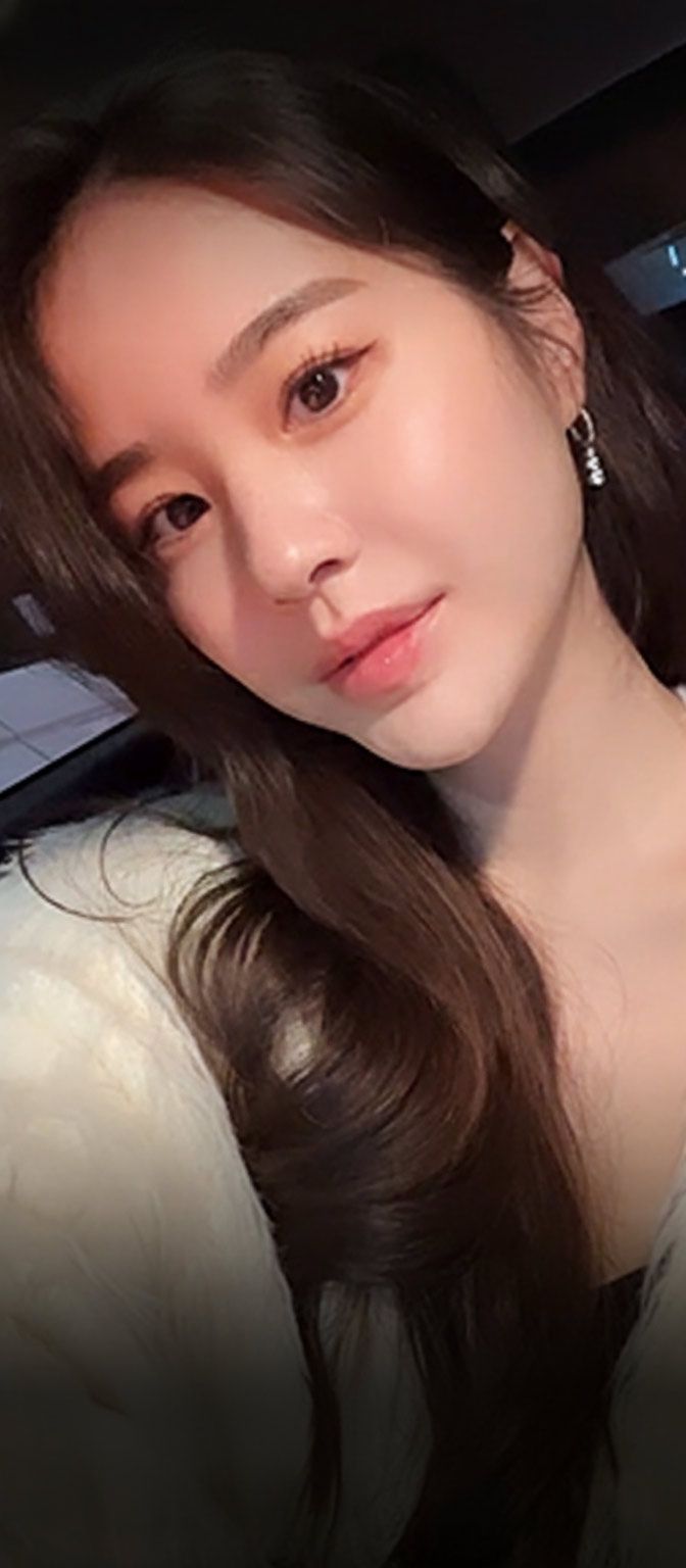 SKETCH Plastic Surgery Shorts: Инцизионная коррекция разреза глаз, Повторная блефаропластика