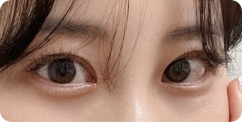인라인