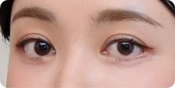 인아웃라인