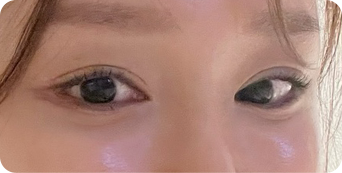 아웃라인
