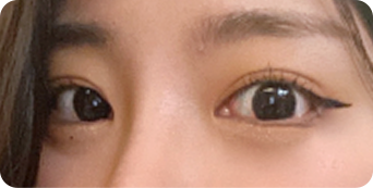 세미아웃라인