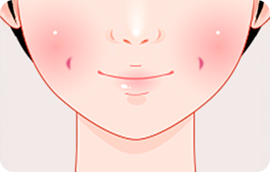 볼 가운데 보조개