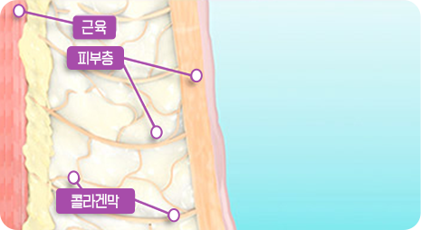 STEP 01 시술전