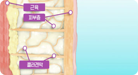 STEP 03 시술후