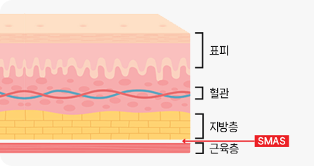 SMAS层剥离