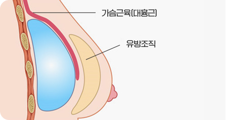 3D双平面法