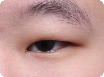 切开 STEP 01