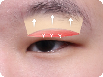 切开 STEP 03