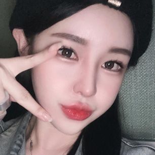 Реальное селфи SKETCH Plastic Surgery 1